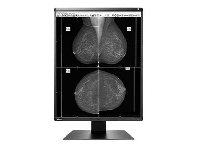 EIZO RadiForce GX560 - LED monitor - 5MP - grayscale - 21.3 - 2048 x 2560 - IPS - 2500 cd/m� - 1700:1 - 12 ms - DVI-D