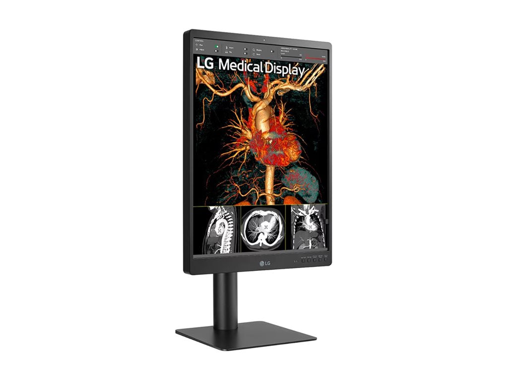 21.3 Inch 3MP Diagnostic Monitor - Medical Imaging Display | Tecisoft 21HQ513D-S
