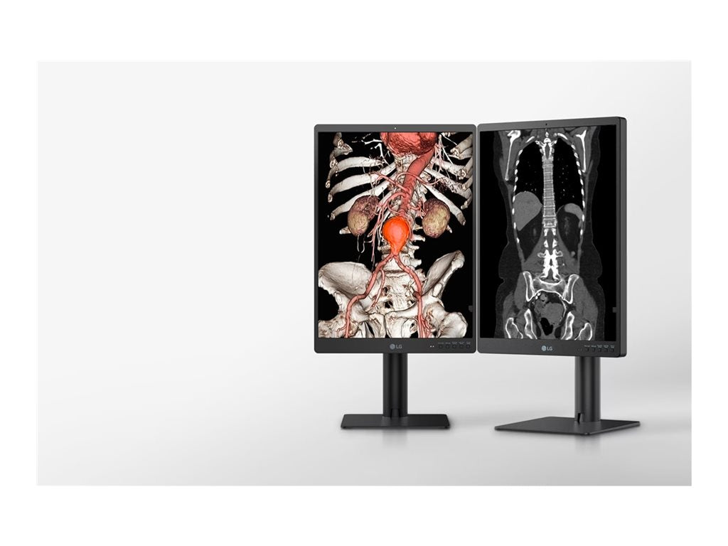 21.3 Inch 3MP Diagnostic Monitor - Medical Imaging Display | Tecisoft 21HQ513D-S