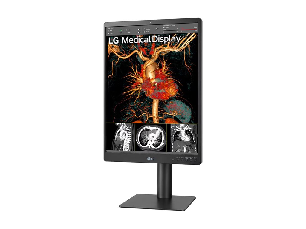 21.3 Inch 3MP Diagnostic Monitor - Medical Imaging Display | Tecisoft 21HQ513D-S