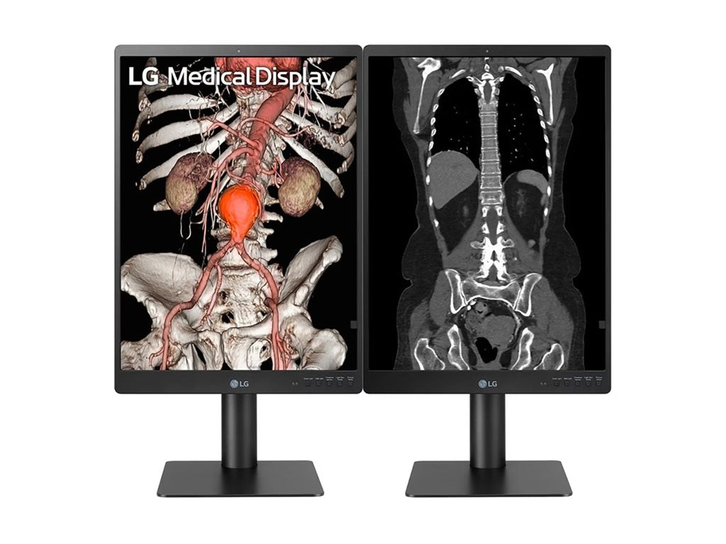 21.3 Inch 3MP Diagnostic Monitor - Medical Imaging Display | Tecisoft 21HQ513D-S