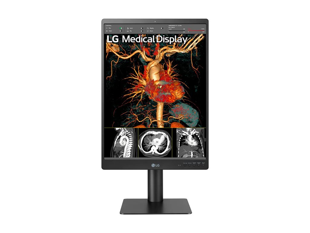 21.3 Inch 3MP Diagnostic Monitor - Medical Imaging Display | Tecisoft 21HQ513D-S