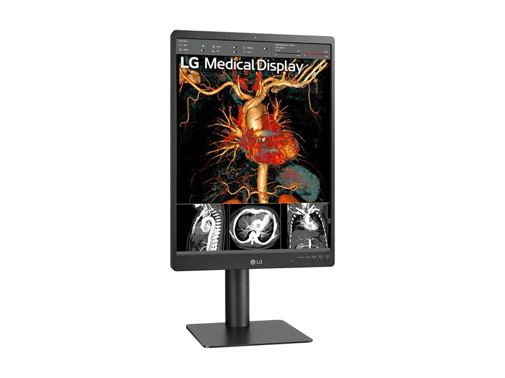 21.3 Inch 3MP Diagnostic Monitor - Medical Imaging Display | Tecisoft 21HQ513D-S