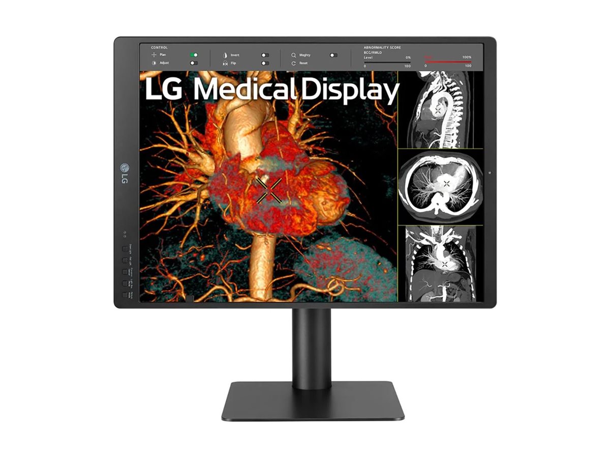 21.3 Inch 3MP Diagnostic Monitor - Medical Imaging Display | Tecisoft 21HQ513D-S