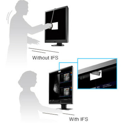 5MP Medical Monitor - RadiForce RX560 Color Display for Breast Imaging | TeCiSoft RX560-BK