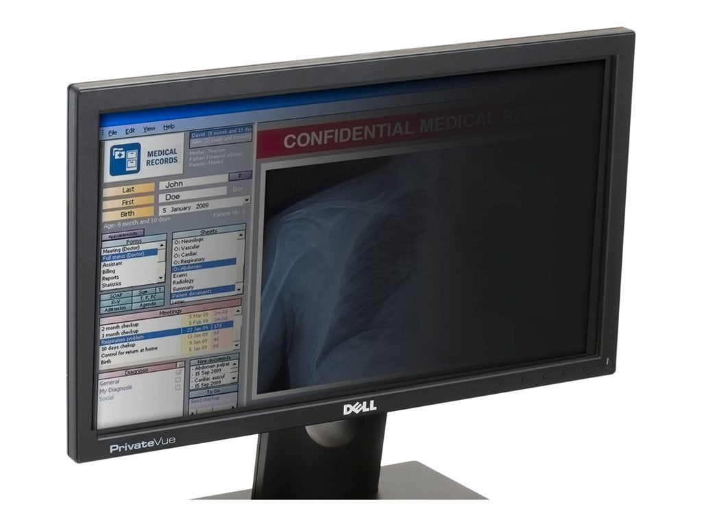 Computer Security Products Guardian Series - Display privacy filter - removable - 15.6 wide - black" G-PF15.6W