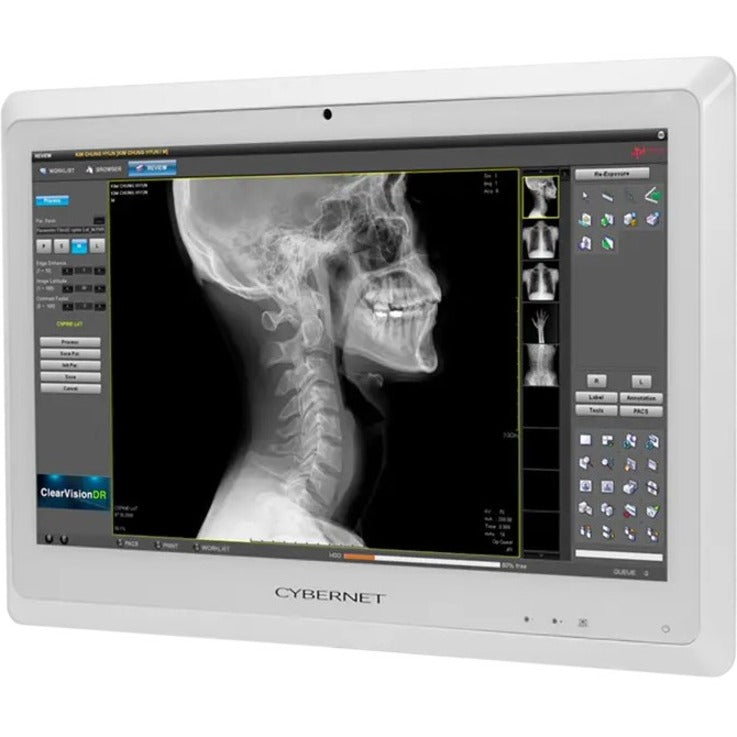 Cybernet CYBERMED-PX24K 24 Class LCD Touchscreen Monitor - 16:9"