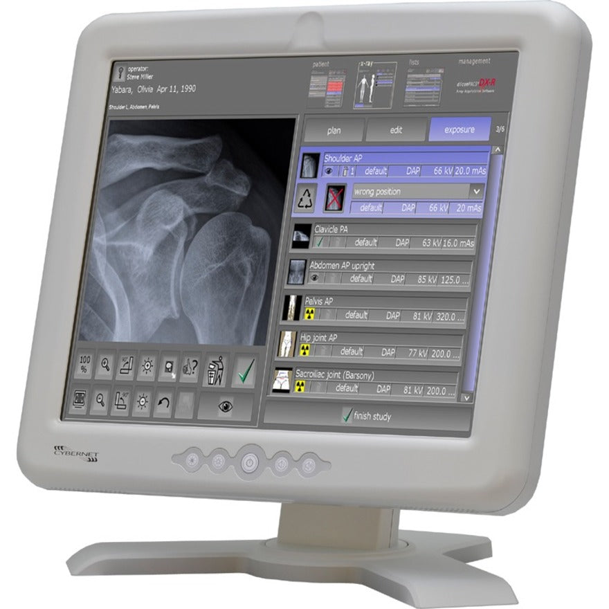 Cybernet CyberMed M17S Barebone System - All-in-One CYBERMED-M17S