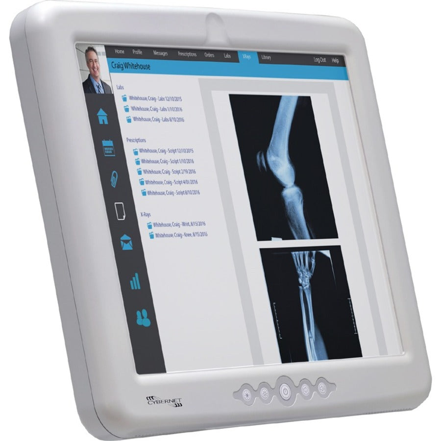 Cybernet CyberMed M17S Barebone System - All-in-One CYBERMED-M17S