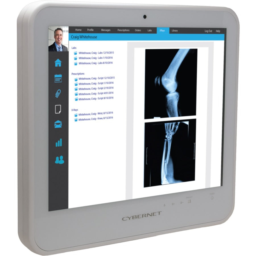 Cybernet CyberMed S S19 All-in-One Computer - Intel Core i5 6th Gen i5-6200U - 8 GB - 128 GB SSD - 19 SXGA Touchscreen - Desktop - White" CYBERMED-S19