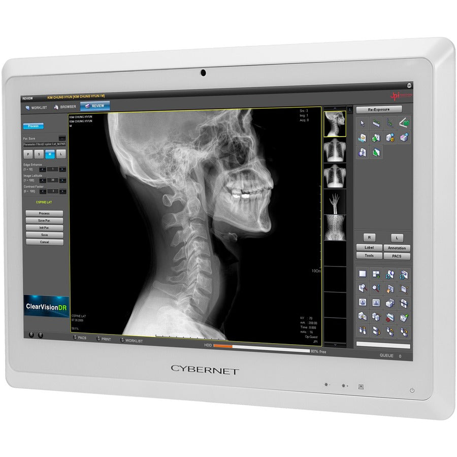 Cybernet CyberMed S S24 All-in-One Computer - Intel Core i5 6th Gen i5-6200U - 8 GB - 128 GB SSD - 23.6 Full HD Touchscreen - Desktop - White" CYBERMED-S24