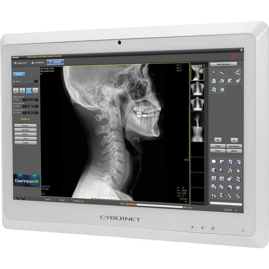 Cybernet CyberMed S S24K All-in-One Computer - Intel Core i5 6th Gen i5-6200U - 8 GB - 128 GB SSD - 23.6 4K UHD Touchscreen - Desktop - White" CYBERMED-S24K