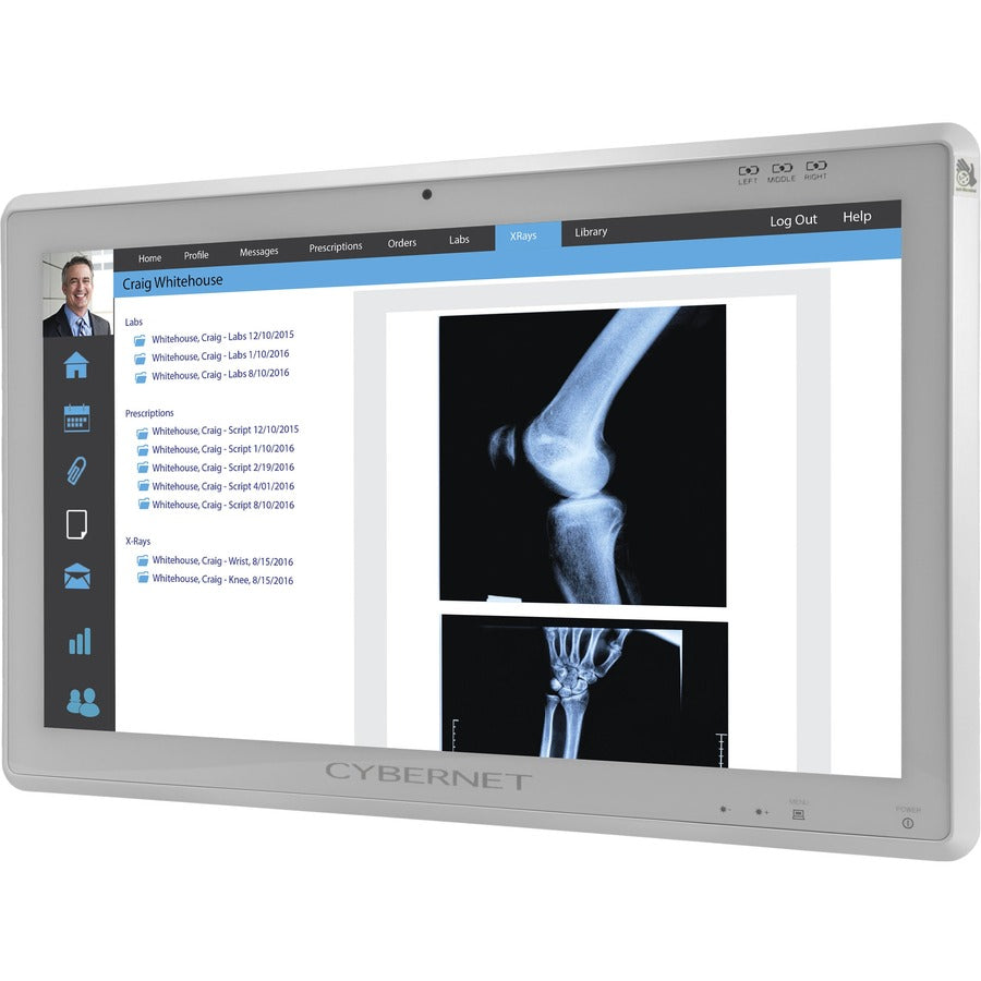 Cybernet CyberMed NB NB24K All-in-One Computer - Intel Core i5 6th Gen i5-6200U - 8 GB - 128 GB SSD - 23.6 4K UHD Touchscreen - Desktop - White" CYBERMED-NB24K