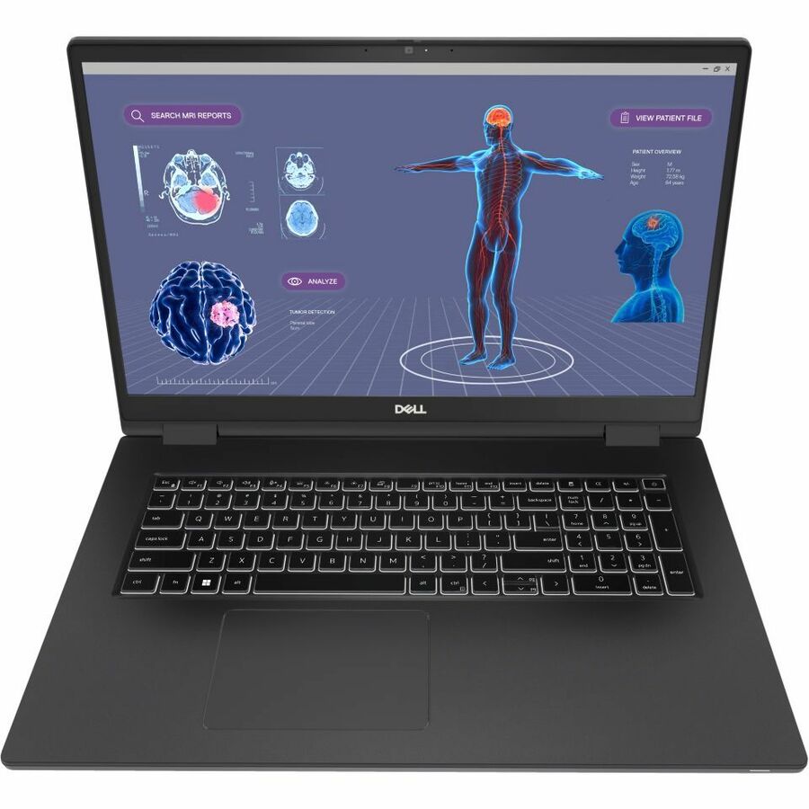 Dell Precision 7000 7780 17.3" Mobile Workstation - Full HD - 1920 x 1080 - Intel Core i9
