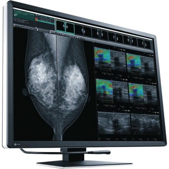 EIZO RadiForce RX1270 12MP 30.9" Medical Imaging Monitor RX1270-BK