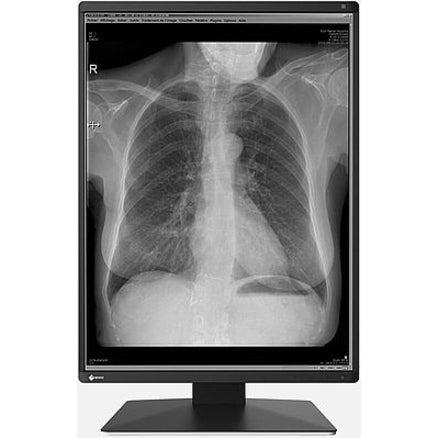 Eizo RadiForce RX250-BK - Medical Display Monitor PACS DICOM Radiology | tecisoft.com