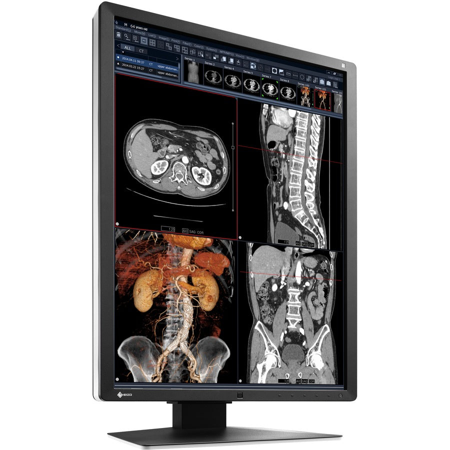 Eizo RadiForce RX250-BK - Medical Display Monitor PACS DICOM Radiology | tecisoft.com