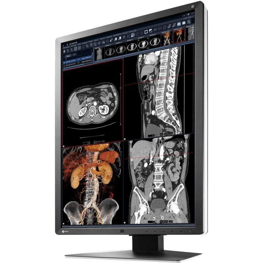Eizo RadiForce RX250-BK - Medical Display Monitor PACS DICOM Radiology | tecisoft.com