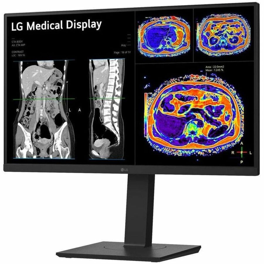 LG 27IN Medical 8MP 4K UHD IPS Clinical Monitor FDA Approved