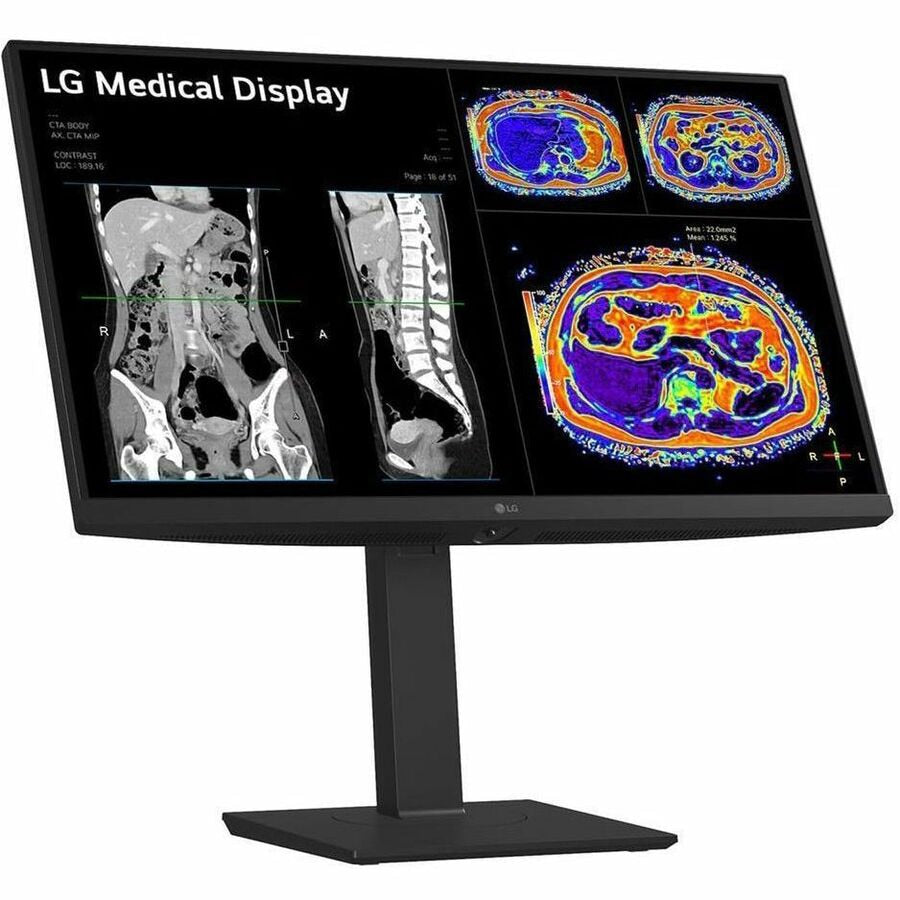 LG 27IN Medical 8MP 4K UHD IPS Clinical Monitor FDA Approved