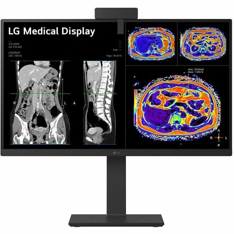 LG 27IN Medical 8MP 4K UHD IPS Clinical Monitor FDA Approved