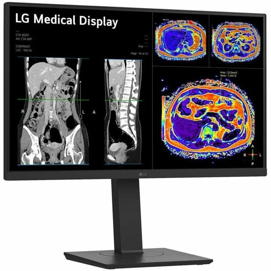 LG 27IN Medical 8MP 4K UHD IPS Clinical Monitor FDA Approved