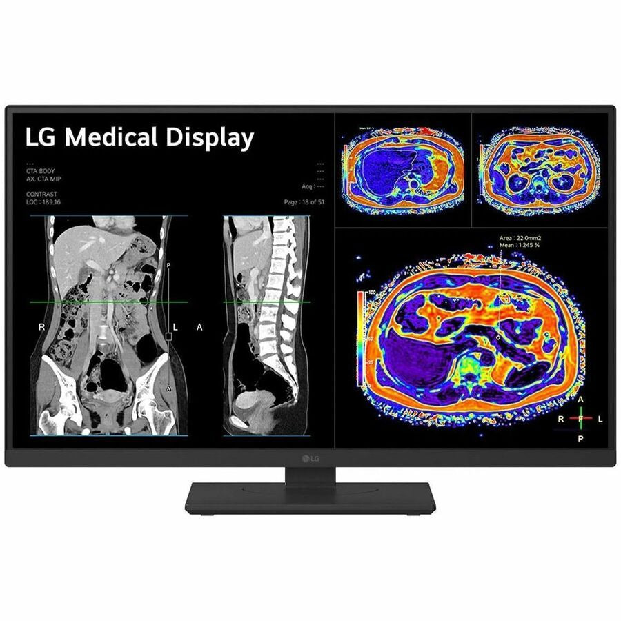 LG 27IN Medical 8MP 4K UHD IPS Clinical Monitor FDA Approved