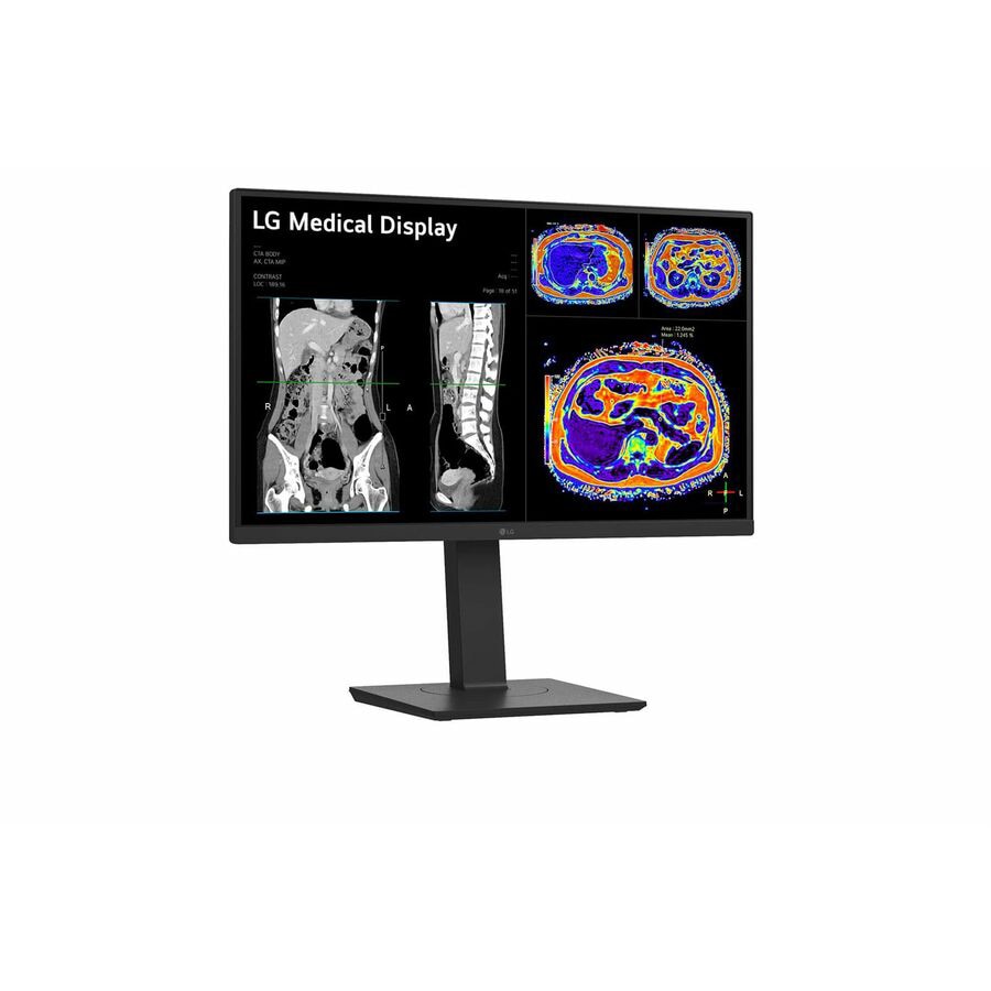 LG 27IN Medical 8MP 4K UHD IPS Clinical Monitor FDA Approved