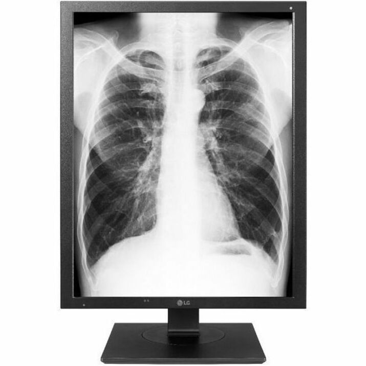 Lenovo 21IN 3MP LG Medical Diagnostic Display Black