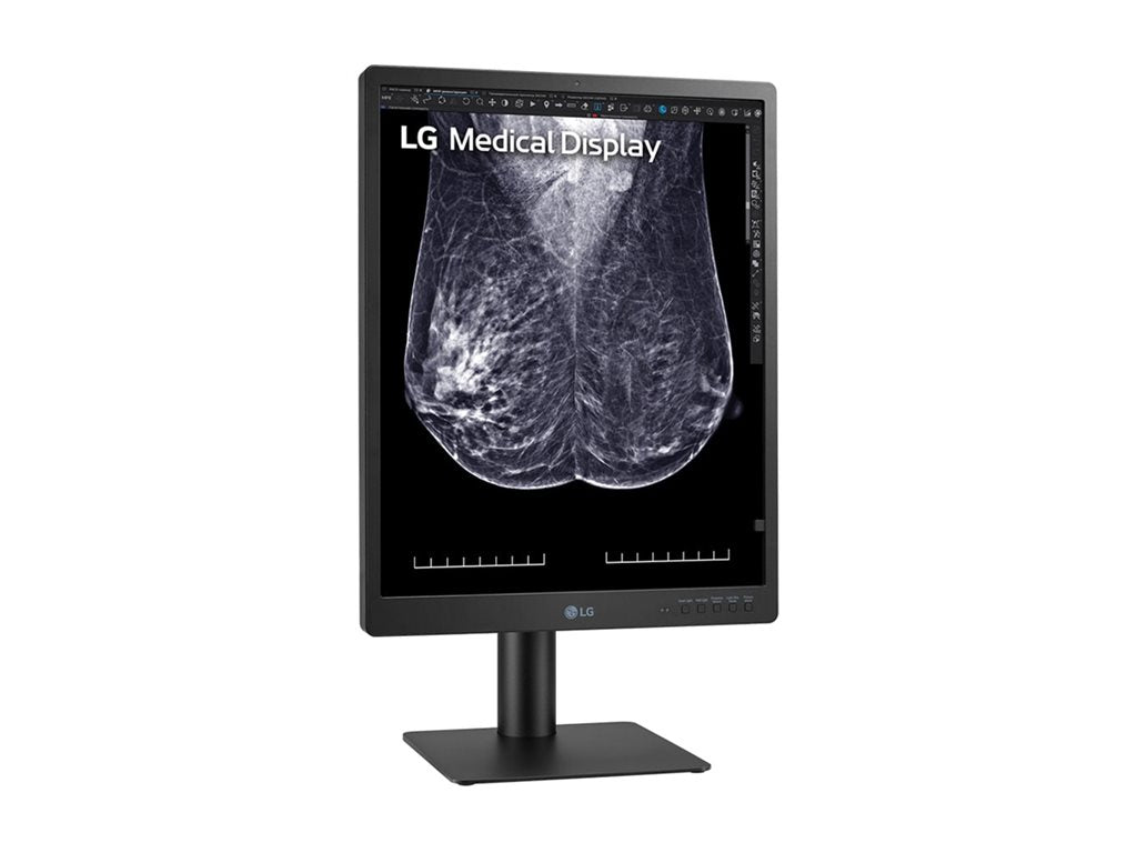 Mammography Monitor - LG 21.3" 5MP IPS Diagnostic Display | Medical Imaging 21HQ613D-B