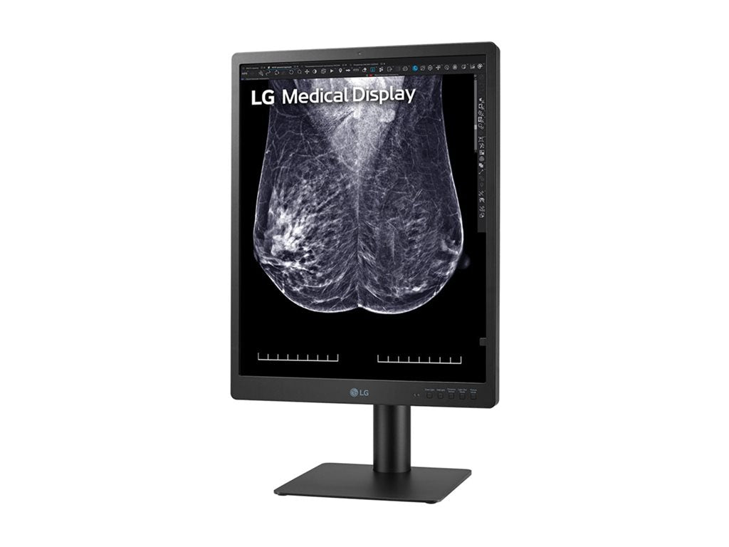 Mammography Monitor - LG 21.3" 5MP IPS Diagnostic Display | Medical Imaging 21HQ613D-B