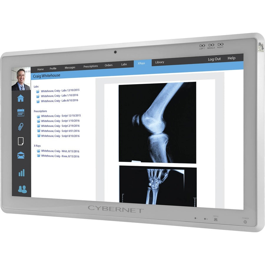 Medical Grade Monitor Battery Powered - CyberMed XB24 Clinical Display | TECISOFT CYBERMED-XB24