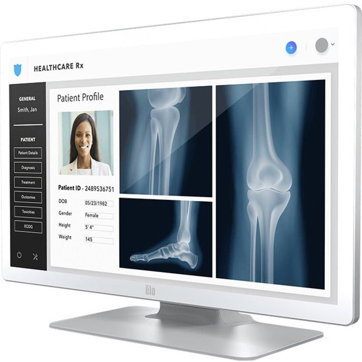 Medical Grade Touchscreen Monitor - DICOM Part 14 Certified Healthcare Display | Elo E659793