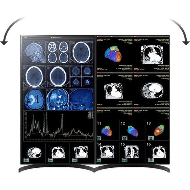 Medical Imaging Monitor 32 Inch - DICOM Calibrated Nano IPS Display | LG 32HL512D-B
