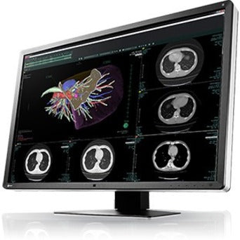 RX660 6MP 30" Medical Monitor - RadiForce | EIZO RX660-BK