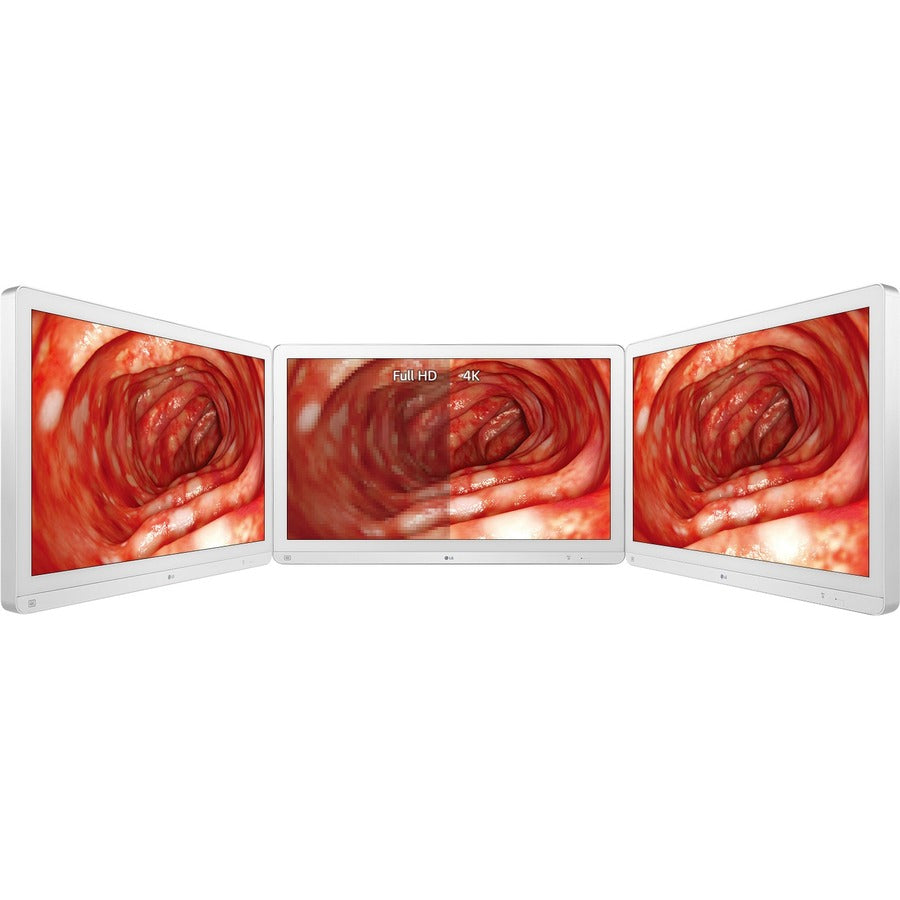 Surgical Monitor 4K - LG 31.5" IPS Medical Display | Tecisoft 32HL714S-W
