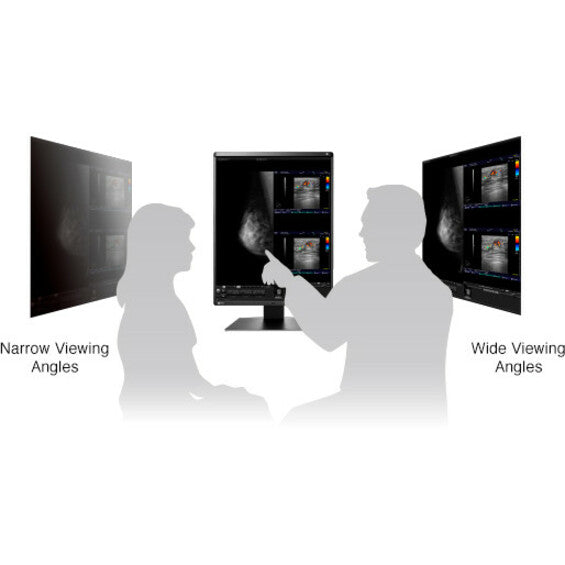 5MP Medical Monitor - RadiForce RX560 Color Display for Breast Imaging | TeCiSoft RX560-BK
