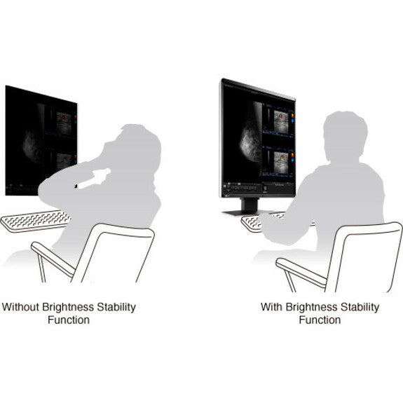 5MP Medical Monitor - RadiForce RX560 Color Display for Breast Imaging | TeCiSoft RX560-BK