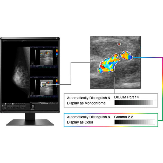 5MP Medical Monitor - RadiForce RX560 Color Display for Breast Imaging | TeCiSoft RX560-BK