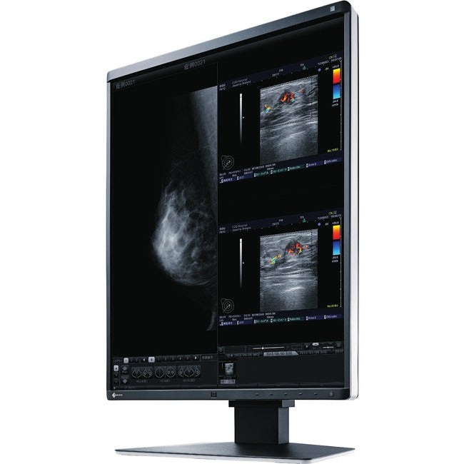 5MP Medical Monitor - RadiForce RX560 Color Display for Breast Imaging | TeCiSoft RX560-BK