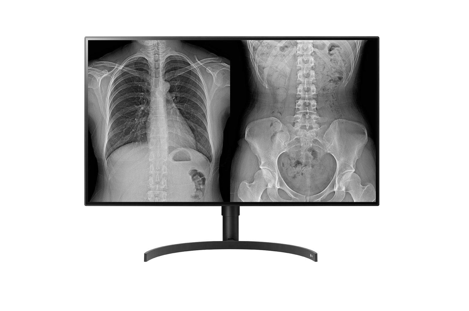 Medical Imaging Monitor 32 Inch - DICOM Calibrated Nano IPS Display | LG 32HL512D-B